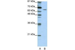 WB Suggested Anti-STAU1 Antibody Titration:  1. (STAU1/Staufen antibody  (N-Term))