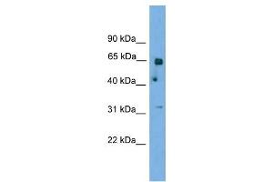 PNKP antibody used at 1 ug/ml to detect target protein. (PNKP antibody  (N-Term))