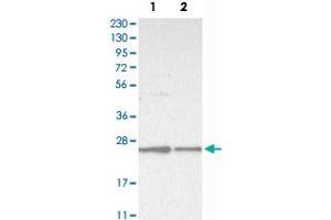 Western Blot analysis of Lane 1: RT-4 and Lane 2: U-251 MG sp cell lysates with VPS28 polyclonal antibody . (VPS28 antibody)