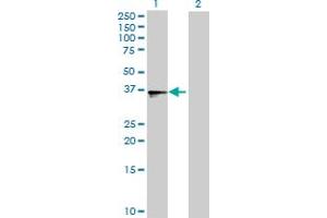 Western Blotting (WB) image for anti-UDP-Gal:betaGlcNAc beta 1,3-Galactosyltransferase, Polypeptide 4 (B3GALT4) (AA 1-378) antibody (ABIN522147)