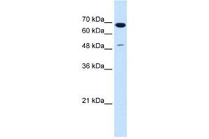 SILV antibody used at 1. (Melanoma gp100 antibody)