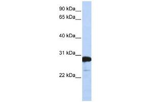 RanBP1 antibody used at 1 ug/ml to detect target protein. (RANBP1 antibody  (C-Term))
