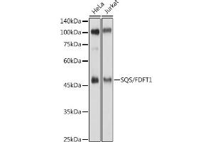 Western blot analysis of extracts of various cell lines, using SQS/FDFT1 antibody (ABIN6130393, ABIN6140567, ABIN6140568 and ABIN6221824) at 1:500 dilution. (FDFT1 antibody  (AA 1-260))