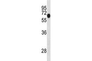 Dyrk1b antibody western blot analysis in mouse lung tissue lysate. (DYRK1B antibody  (AA 376-403))