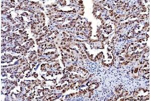 IHC analysis of FEN1 using anti-FEN1 antibody (ABIN7601618).