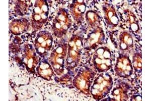 Immunohistochemistry of paraffin-embedded human small intestine tissue using ABIN7175937 at dilution of 1:100 (SLC7A6 antibody  (AA 473-515))