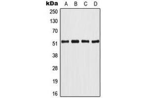 Western blot analysis of ATF2 expression in HeLa (A), NIH3T3 (B), PC12 (C), rat brain (D) whole cell lysates.