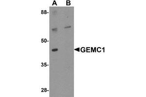 Western blot analysis of GEMC1 in mouse heart tissue lysate with GEMC1 antibody at 1 μg/mL in (A) the absence and (B) the presence of blocking peptide (GEMC1 antibody  (Center))