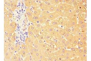 Immunohistochemistry of paraffin-embedded human liver tissue using ABIN7171658 at dilution of 1:100 (TBC1D7 antibody  (AA 1-293))
