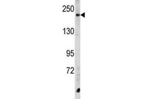 Western blot analysis of CPD antibody and HeLa lysate. (CPD antibody  (AA 1019-1048))