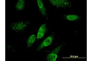 Immunofluorescence of monoclonal antibody to ZNHIT3 on HeLa cell. (ZNHIT3 antibody  (AA 1-155))