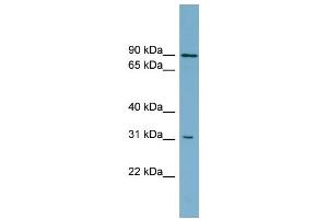 WB Suggested Anti-ABCD2 Antibody Titration:  0. (CCL17 antibody  (Middle Region))
