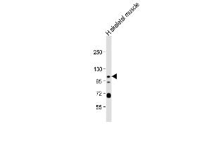 Anti-KCNQ5 Antibody (C-term) at 1:1000 dilution + human skeletal muscle lysate Lysates/proteins at 20 μg per lane. (KCNQ5 antibody  (C-Term))