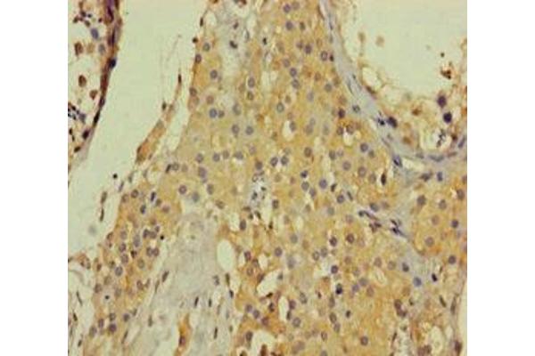 Collagen, Type VI, alpha 6 (COL6A6) (AA 430-982) antibody