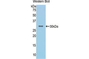 Detection of Recombinant CFI, Human using Polyclonal Antibody to Complement Factor I (CFI) (Complement Factor I antibody  (AA 340-583))