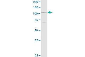 DSG1 MaxPab rabbit polyclonal antibody. (Desmoglein 1 antibody  (AA 1-1049))
