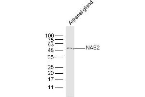 Mouse adrenal Gland lysates probed with NAB2 Polyclonal Antibody, Unconjugated  at 1:300 dilution and 4˚C overnight incubation. (NAB2 antibody  (AA 221-320))