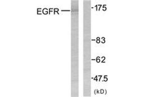 Western blot analysis of extracts from SK-OV3 cells, using EGFR (Ab-1070) Antibody. (EGFR antibody  (AA 1041-1090))