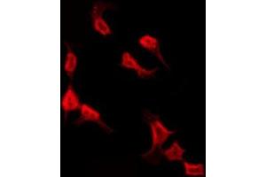 ABIN6277252 staining HepG2 by IF/ICC. (RPS3 antibody  (Internal Region))