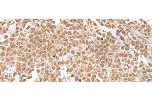 ZNF560 antibody