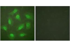 Immunofluorescence analysis of HeLa cells, using JAB1 Antibody. (COPS5 antibody  (AA 374-423))