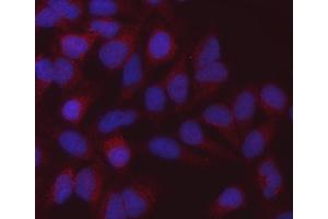 IF analysis of MDH2 using anti-MDH2 antibody (ABIN7602617).