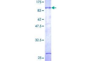 Dystrobrevin beta Protein (AA 1-560) (GST tag)