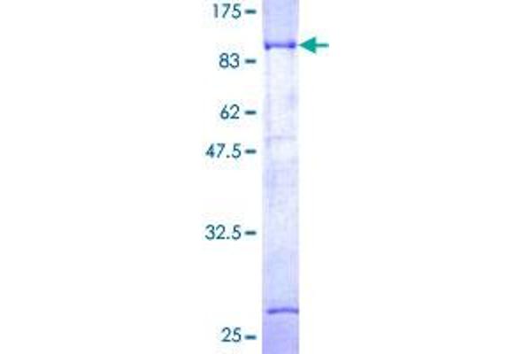 Dystrobrevin beta Protein (AA 1-560) (GST tag)