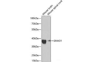Western blot analysis of extracts of various cell lines using GNAO1 Polyclonal Antibody at dilution of 1:1000. (GNAO1 antibody)