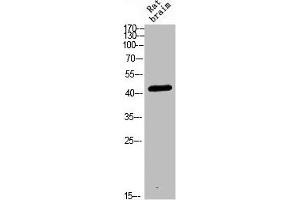 Western blot analysis of RAT-BRAIN Cell Lysate, antibody was diluted at 1:1000. (CRHR2 antibody  (AA 1268-1341))