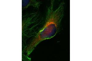 Indirect immunofluorescence on HELA cells (dilution 1 : 500; red) in combination with anti-α-tubulin (cat. (VAMP8 antibody  (Cytoplasmic Domain))