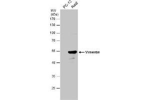 Vimentin antibody