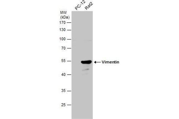 Vimentin antibody