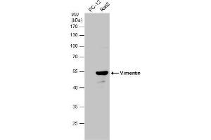 WB Image Various whole cell extracts (30 μg) were separated by 10% SDS-PAGE, and the membrane was blotted with Vimentin antibody , diluted at 1:10000. (Vimentin antibody)