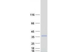 Western Blotting (WB) image for Zinc Finger Protein 174 (ZNF174) (Transcript Variant 2) protein (Myc-DYKDDDDK Tag) (ABIN2735936)