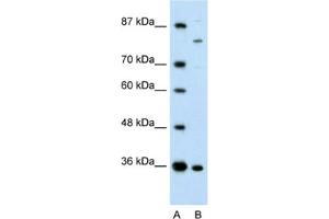 Western Blotting (WB) image for anti-Ankyrin Repeat and Zinc Finger Domain Containing 1 (ANKZF1) antibody (ABIN2461250) (ANKZF1 antibody)