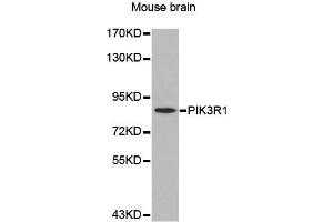 Western Blotting (WB) image for anti-Phosphoinositide 3 Kinase, p85 alpha (PI3K p85a) (AA 1-300) antibody (ABIN6213600) (PIK3R1 antibody  (AA 1-300))