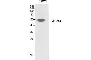 Western Blot analysis of SKOV3 cells using Glut4 Polyclonal Antibody.