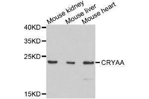 Western blot analysis of extracts of various cell lines, using CRYAA antibody. (CRYAA antibody  (AA 1-173))