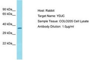 Image no. 1 for anti-YdjC Homolog (YdjC) (AA 217-266) antibody (ABIN6750767) (YdjC antibody  (AA 217-266))