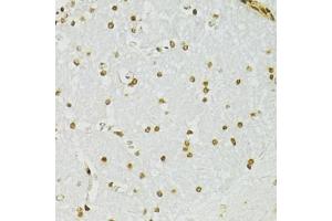 Immunohistochemistry of paraffin-embedded mouse brain using ADAR antibody (ABIN5975213) at dilution of 1/100 (40x lens). (ADAR antibody)