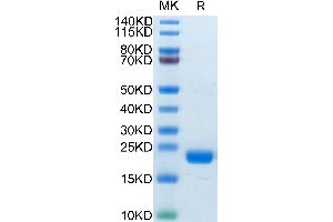 Biotinylated Human CD20 on Tris-Bis PAGE under reduced condition. (CD20 Protein (AA 141-188) (His-Avi Tag,Biotin))