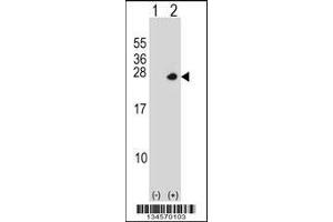 Western blot analysis of PSMD10 using rabbit polyclonal PSMD10 Antibody using 293 cell lysates (2 ug/lane) either nontransfected (Lane 1) or transiently transfected (Lane 2) with the PSMD10 gene. (PSMD10 antibody  (C-Term))