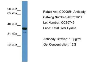 WB Suggested Anti-CD200R1  Antibody Titration: 0. (CD200R1 antibody  (N-Term))