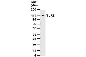 Western Blotting (WB) image for anti-Toll-Like Receptor 8 (TLR8) antibody (ABIN187558) (TLR8 antibody)