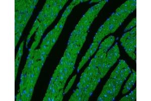 IF analysis of CPT1B using anti-CPT1B antibody (ABIN3042757).