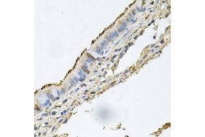 Immunohistochemistry of paraffin-embedded human trachea using DSG1 antibody. (Desmoglein 1 antibody  (AA 800-1049))