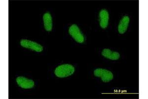 Immunofluorescence of purified MaxPab antibody to PRAM1 on HepG2 cell. (PRAM1 antibody  (AA 1-670))
