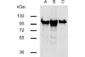 Western blotting analysis of beta-catenin in murine 3T3 (A), C57 (B) and KW1 (C) cell lines using antibody. (beta Catenin antibody)
