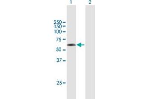 Western Blot analysis of TSEN2 expression in transfected 293T cell line by TSEN2 MaxPab polyclonal antibody. (TSEN2 antibody  (AA 1-465))